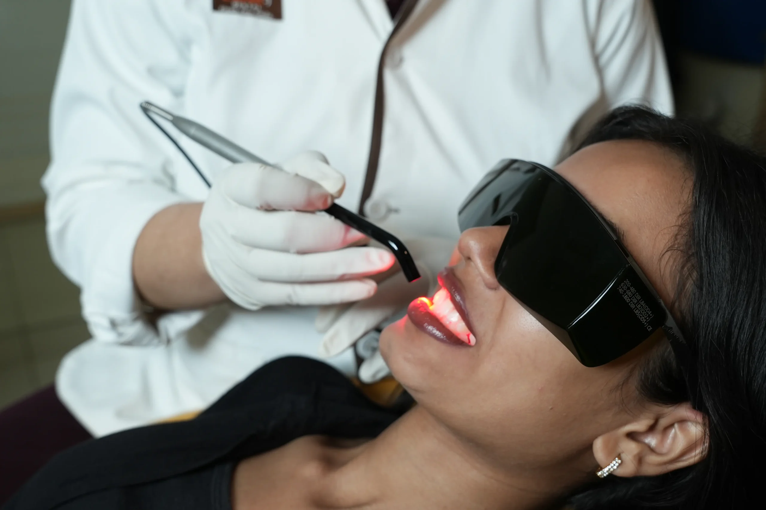 Gummy smile treatment