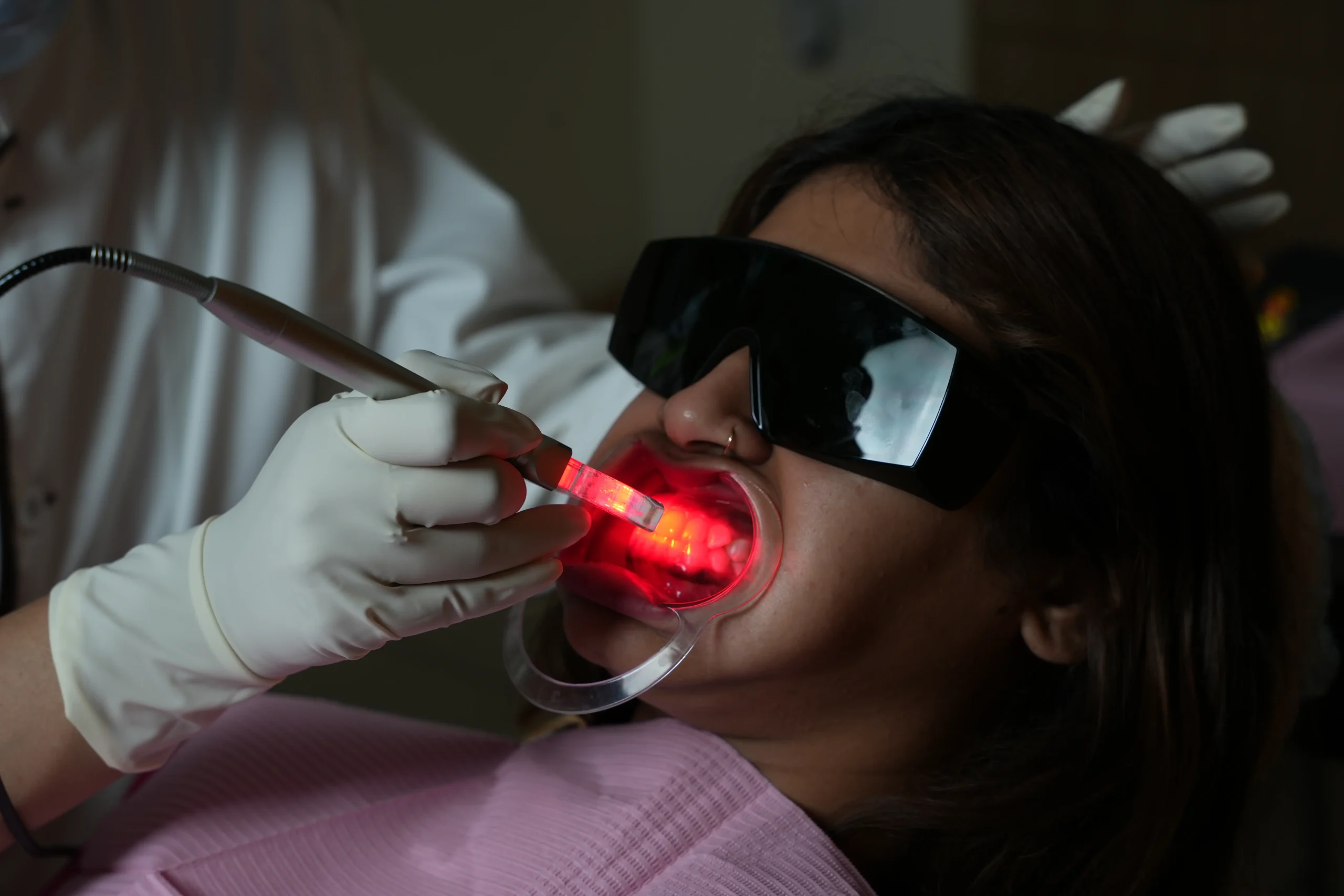 Gummy smile treatment
