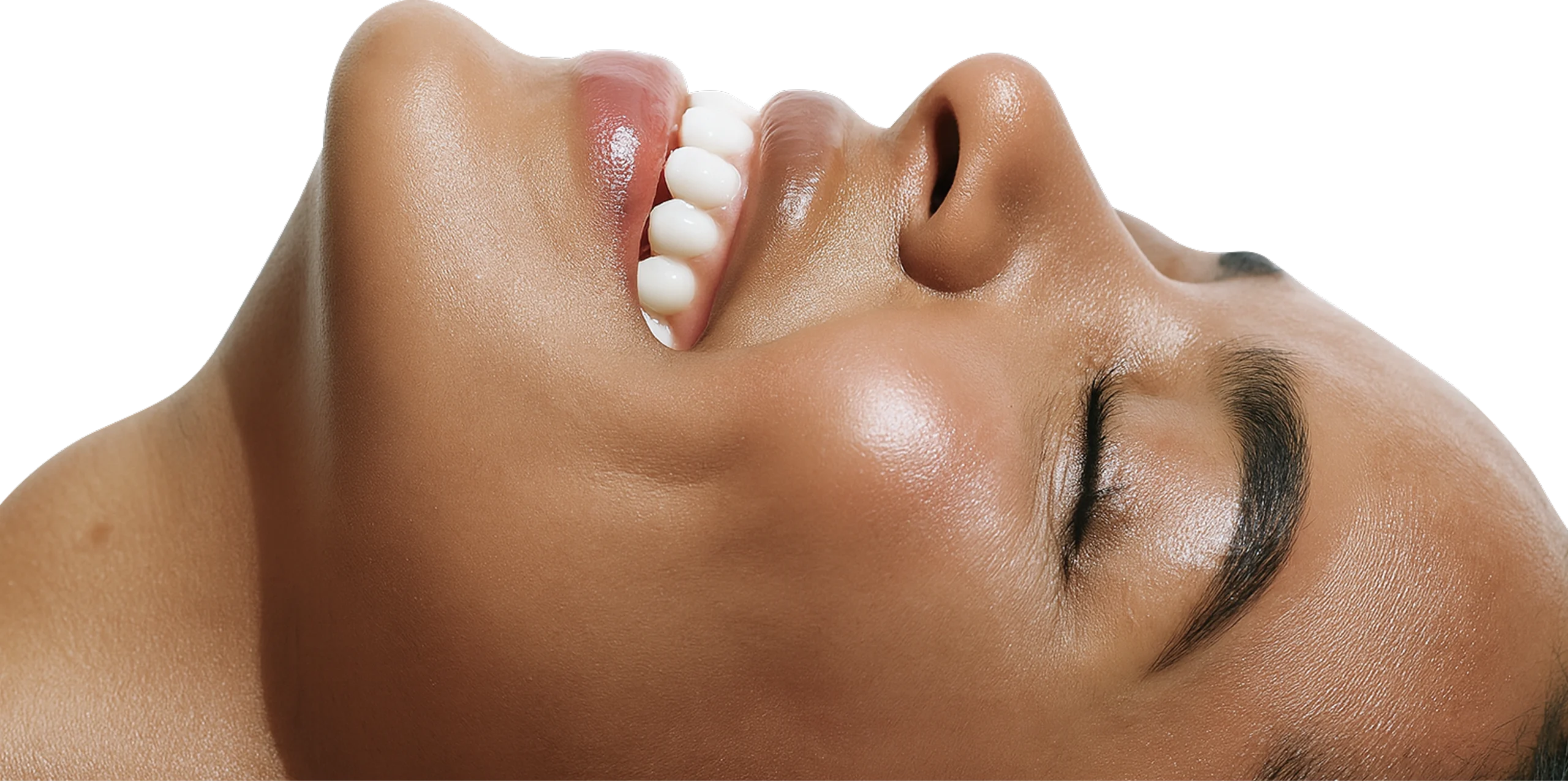 Dental before and after