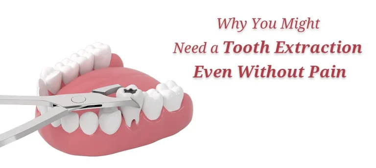 Top Reasons for Tooth Extraction Without Pain